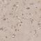 Proteasome 20S beta2 subunit antibody, NBP1-92294, Novus Biologicals, Immunohistochemistry paraffin image 