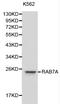 RAB7A, Member RAS Oncogene Family antibody, LS-C192407, Lifespan Biosciences, Western Blot image 