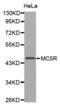 Melanocortin 5 Receptor antibody, abx002185, Abbexa, Western Blot image 