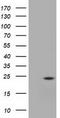 Ubiquitin Conjugating Enzyme E2 T antibody, TA501645, Origene, Western Blot image 