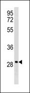 Leucine Rich Repeat Containing 61 antibody, PA5-49311, Invitrogen Antibodies, Western Blot image 
