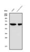 Neuraminidase antibody, GTX03696, GeneTex, Western Blot image 