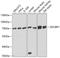 Insulin Like Growth Factor 2 MRNA Binding Protein 1 antibody, 15-913, ProSci, Western Blot image 