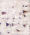 Platelet Derived Growth Factor Subunit A antibody, 59-024, ProSci, Immunohistochemistry paraffin image 