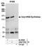 Valyl-TRNA Synthetase antibody, A304-776A, Bethyl Labs, Immunoprecipitation image 