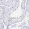 PR/SET Domain 7 antibody, NBP2-32504, Novus Biologicals, Immunohistochemistry paraffin image 