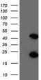 Centromere Protein H antibody, LS-C173490, Lifespan Biosciences, Western Blot image 