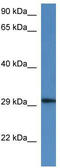 Harbinger Transposase Derived 1 antibody, TA331418, Origene, Western Blot image 