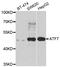 Cyclic AMP-dependent transcription factor ATF-7 antibody, LS-C349255, Lifespan Biosciences, Western Blot image 
