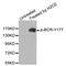 BCR Activator Of RhoGEF And GTPase antibody, MBS128283, MyBioSource, Western Blot image 