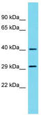 Methionyl Aminopeptidase Type 1D, Mitochondrial antibody, TA334827, Origene, Western Blot image 