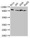 Metastasis-associated in colon cancer protein 1 antibody, CSB-PA761627LA01HU, Cusabio, Western Blot image 