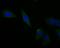 TNF Receptor Superfamily Member 11b antibody, NBP2-76904, Novus Biologicals, Immunofluorescence image 