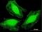 Armadillo Repeat Containing 1 antibody, H00055156-B01P, Novus Biologicals, Immunocytochemistry image 