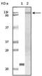 Tyrosine Kinase 2 antibody, AM06139SU-N, Origene, Western Blot image 