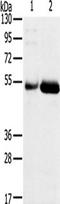 Sterile Alpha Motif Domain Containing 3 antibody, TA350387, Origene, Western Blot image 