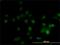 Diphthamide Biosynthesis 1 antibody, H00001801-M02, Novus Biologicals, Immunocytochemistry image 