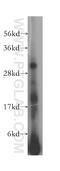 Major Histocompatibility Complex, Class II, DQ Beta 2 antibody, 17315-1-AP, Proteintech Group, Western Blot image 