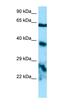 Apolipoprotein B MRNA Editing Enzyme Catalytic Subunit 3H antibody, orb326520, Biorbyt, Western Blot image 