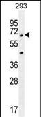 Ankyrin Repeat Domain 34B antibody, PA5-35050, Invitrogen Antibodies, Western Blot image 