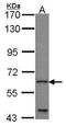 Zinc finger protein GLIS1 antibody, TA308597, Origene, Western Blot image 