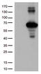 Kelch Like ECH Associated Protein 1 antibody, CF502059, Origene, Western Blot image 