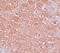 Solute Carrier Family 39 Member 12 antibody, A10066, Boster Biological Technology, Immunohistochemistry paraffin image 