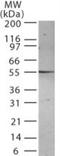 Presenilin 2 antibody, NB100-56677, Novus Biologicals, Western Blot image 