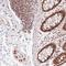 Zinc Finger And BTB Domain Containing 44 antibody, HPA052589, Atlas Antibodies, Immunohistochemistry frozen image 