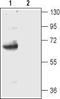 GLT-1 antibody, TA328838, Origene, Western Blot image 