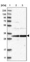Exosome Component 2 antibody, PA5-54510, Invitrogen Antibodies, Western Blot image 