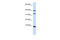 ACBP antibody, ARP33135_P050, Aviva Systems Biology, Western Blot image 