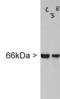Internexin Neuronal Intermediate Filament Protein Alpha antibody, LS-B10381, Lifespan Biosciences, Western Blot image 