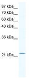 Regulator Of G Protein Signaling 10 antibody, TA330398, Origene, Western Blot image 
