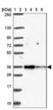 Translocase Of Outer Mitochondrial Membrane 34 antibody, NBP2-38810, Novus Biologicals, Western Blot image 