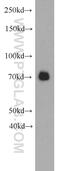 Semaphorin 3C antibody, 19242-1-AP, Proteintech Group, Western Blot image 