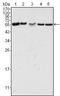P21 (RAC1) Activated Kinase 2 antibody, MA5-15527, Invitrogen Antibodies, Western Blot image 