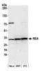 BAP antibody, A300-657A, Bethyl Labs, Western Blot image 