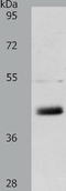 Lymphatic Vessel Endothelial Hyaluronan Receptor 1 antibody, TA321777, Origene, Western Blot image 