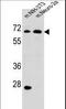 Malate dehydrogenase 2, mitochondrial antibody, LS-C164112, Lifespan Biosciences, Western Blot image 