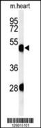 Keratin 82 antibody, 61-771, ProSci, Western Blot image 