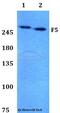 Coagulation Factor V antibody, A00440, Boster Biological Technology, Western Blot image 