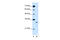 Solute Carrier Family 25 Member 22 antibody, 29-939, ProSci, Western Blot image 