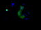 Bruton Tyrosine Kinase antibody, LS-C115133, Lifespan Biosciences, Immunofluorescence image 