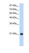 60S ribosomal protein L9 antibody, NBP1-57387, Novus Biologicals, Western Blot image 