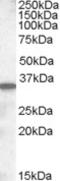 Solute Carrier Family 10 Member 2 antibody, TA305877, Origene, Western Blot image 