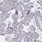 Ectonucleotide Pyrophosphatase/Phosphodiesterase 1 antibody, HPA062066, Atlas Antibodies, Immunohistochemistry frozen image 