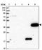 Ring Finger Protein 39 antibody, PA5-61431, Invitrogen Antibodies, Western Blot image 