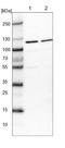 Ring Finger Protein 17 antibody, NBP1-83782, Novus Biologicals, Western Blot image 