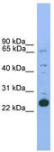 NK2 Homeobox 6 antibody, TA342286, Origene, Western Blot image 